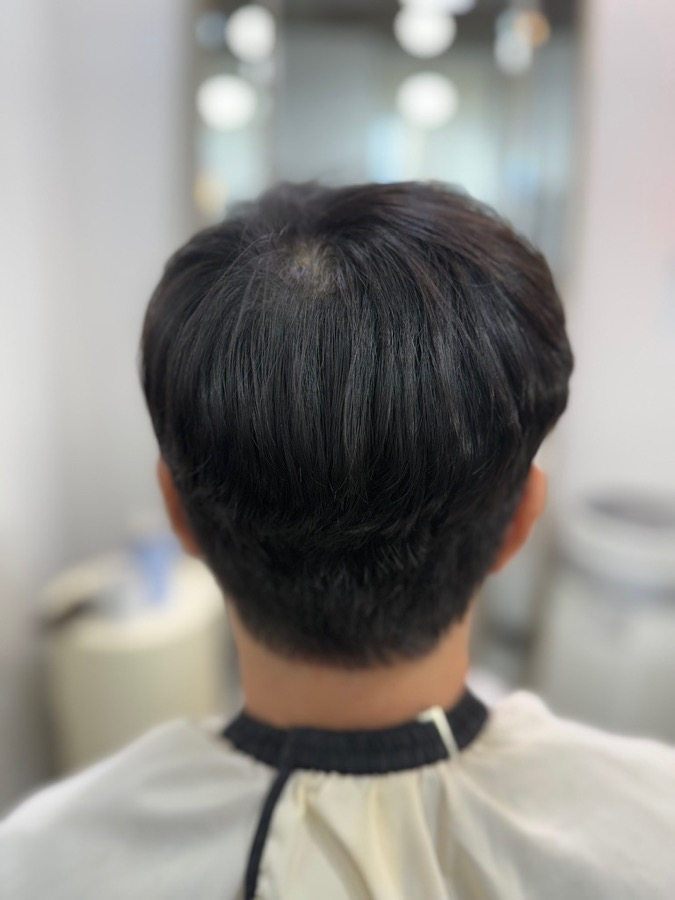 case1 after