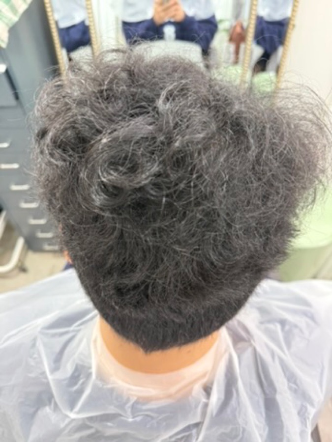 case7 before